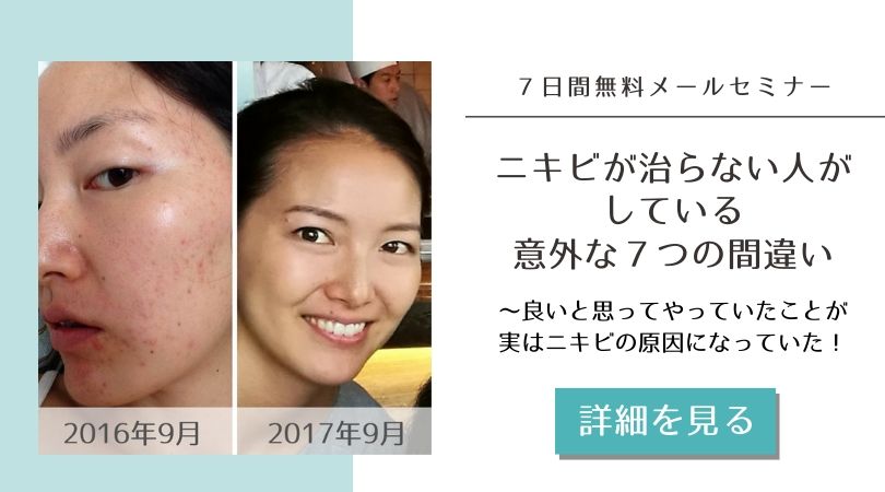 ニキビが治らない人がしている意外な7つの間違い