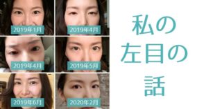 私の左目の話。「見た目」を気にしすぎることの落とし穴