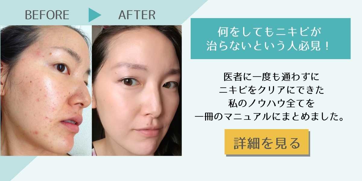 CLEAR NIKIBI MANUAL 皮膚科に行かずライフスタイル改善だけでニキビをクリアにしたノウハウ
